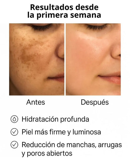 kit de Rutina completa niacinamia +obsequio